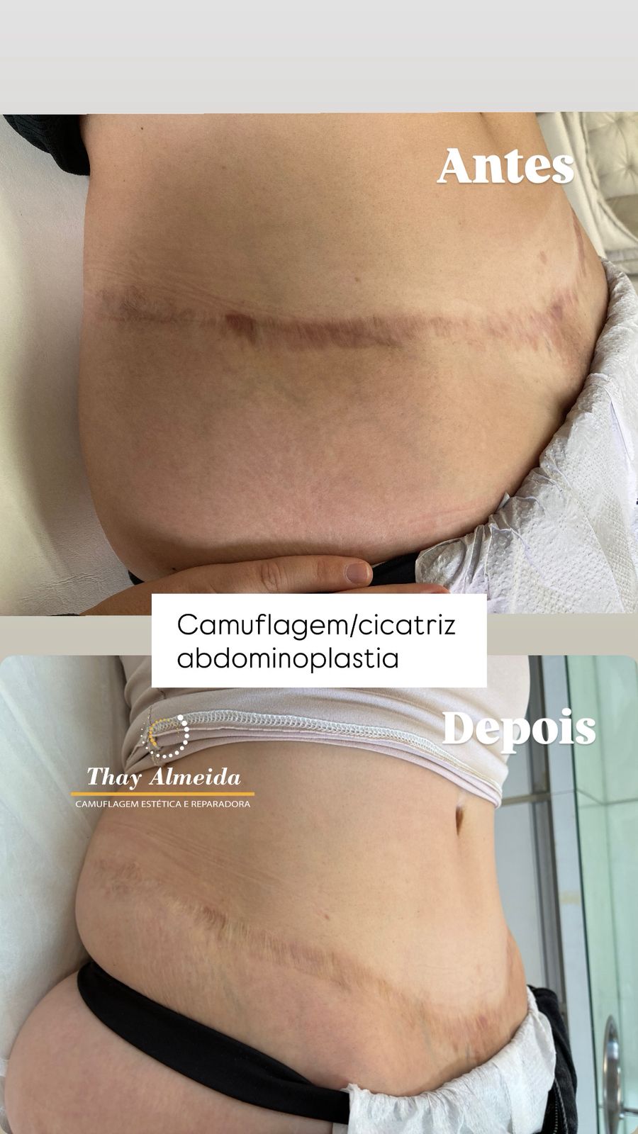 Resultado camuflagem paramédica