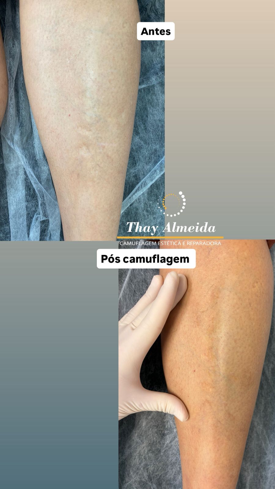 Resultado camuflagem paramédica