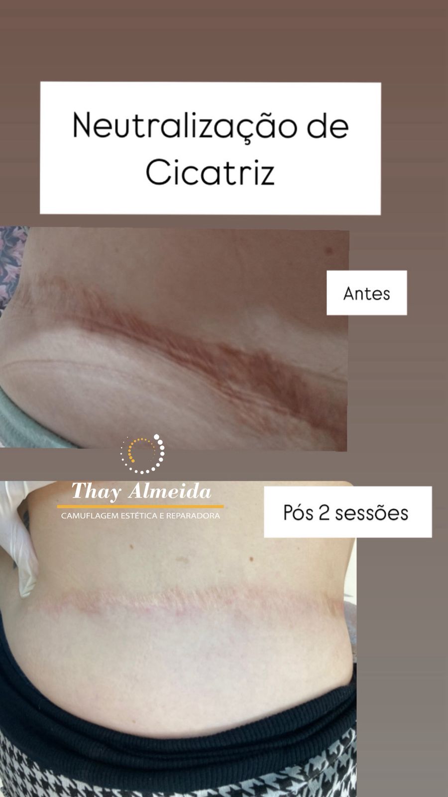 Resultado camuflagem paramédica