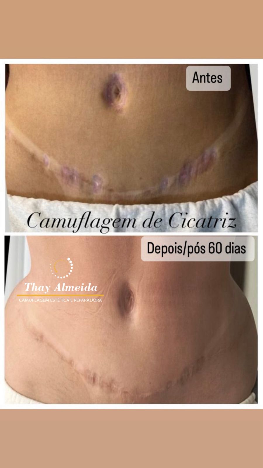 Resultado camuflagem paramédica