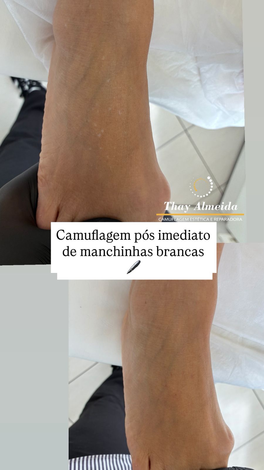 Resultado camuflagem paramédica